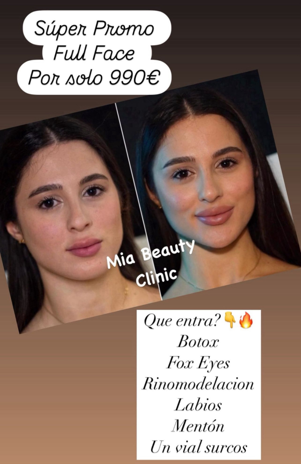 Full Face